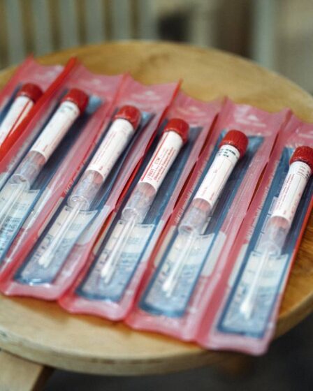 Étude: Les patients atteints de COVID gravement malades en Afrique ont un risque beaucoup plus élevé de mourir - 27