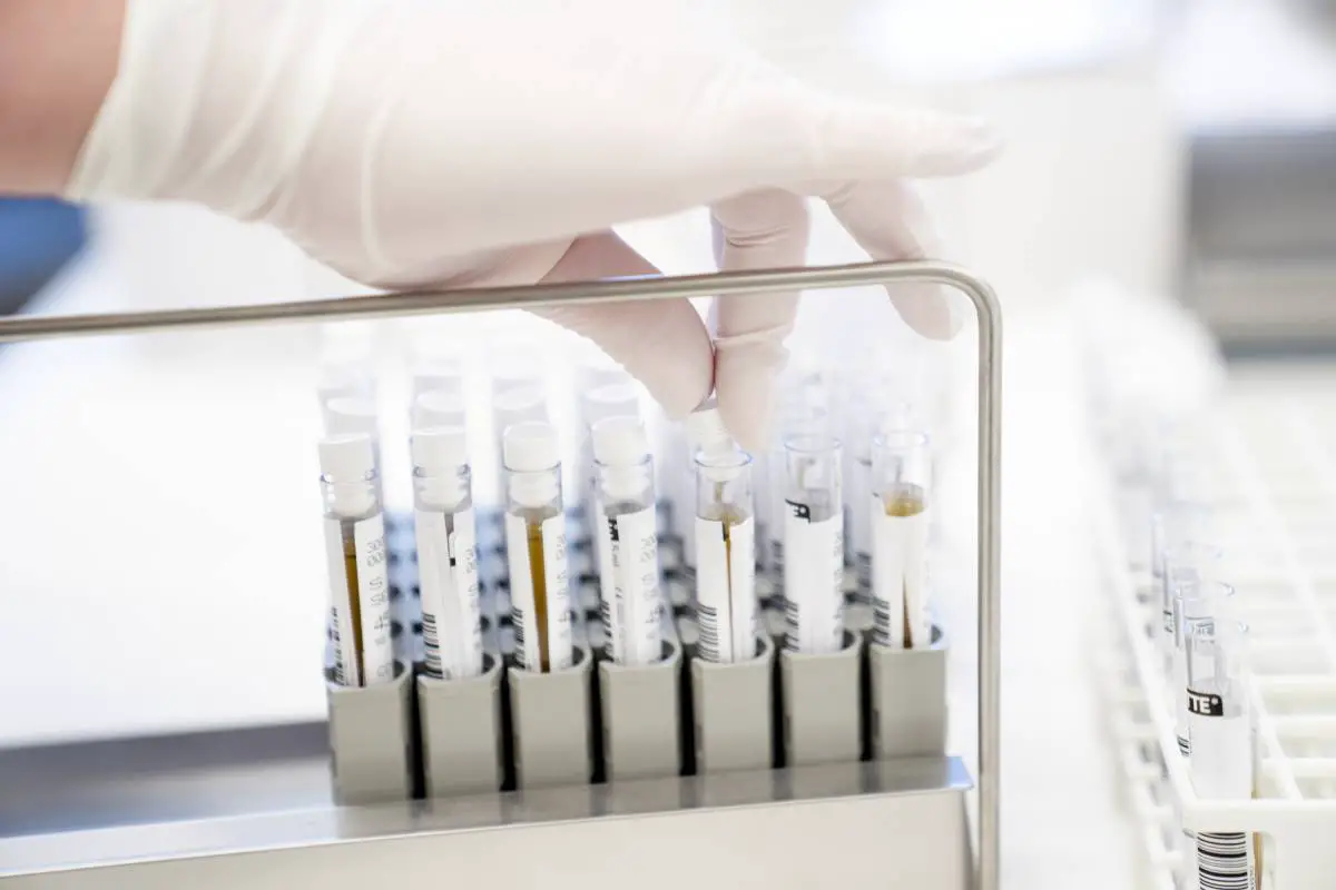 La Norvège enregistre le plus grand nombre de patients corona hospitalisés depuis fin mai 4 La Norvège enregistre le plus grand nombre de patients corona hospitalisés depuis fin mai - 3