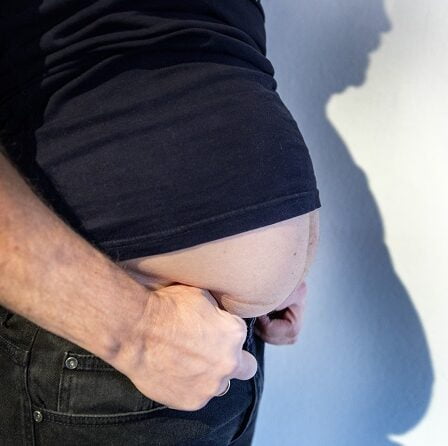 Un patient sur trois atteint de coronavirus avait l'obésité comme facteur de risque 17 Un patient sur trois atteint de coronavirus avait l'obésité comme facteur de risque - 16