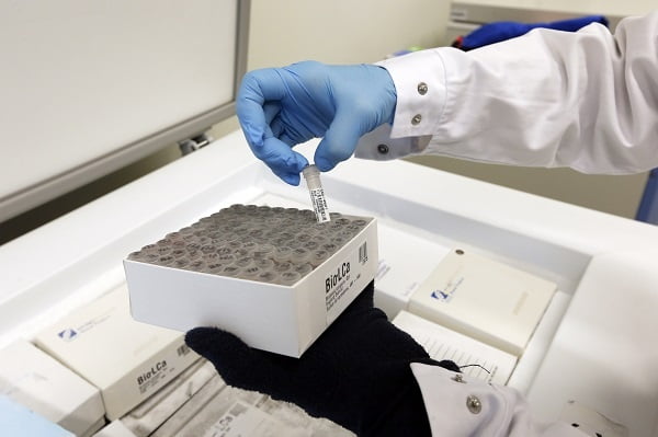 Une nouvelle méthode norvégienne détecte un cancer de l'intestin en trois minutes 4 Une nouvelle méthode norvégienne détecte un cancer de l'intestin en trois minutes - 3