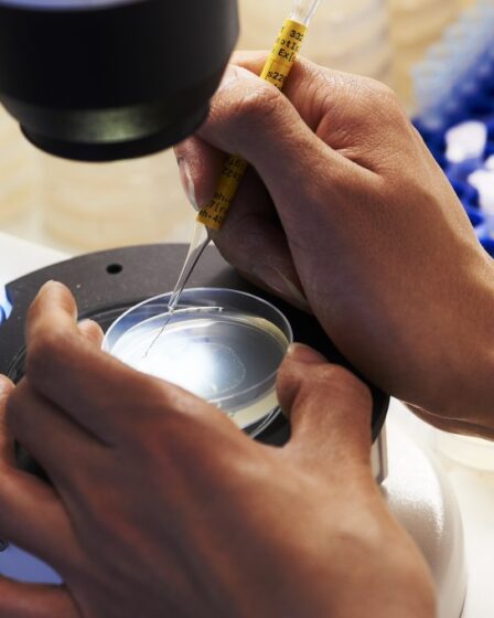 Des scientifiques espagnols créent du sperme à partir de cellules cutanées 8 Des scientifiques espagnols créent du sperme à partir de cellules cutanées - 7