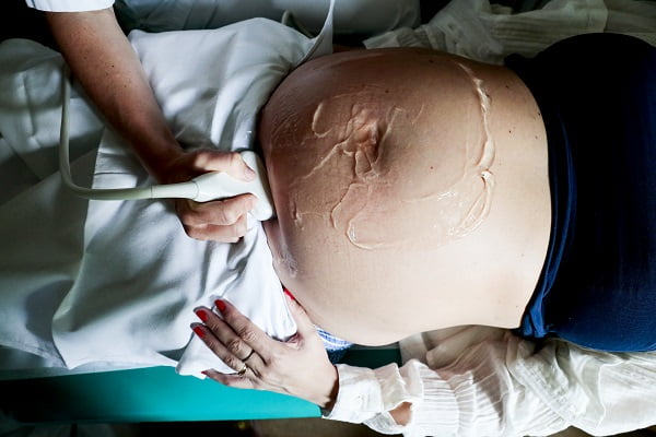 7 sur 10 poursuivent leur grossesse malgré la maladie du fœtus 4 7 sur 10 poursuivent leur grossesse malgré la maladie du fœtus - 3
