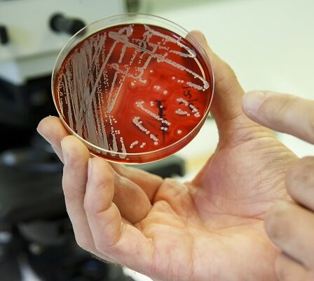 Environ 70 personnes meurent chaque année de bactéries résistantes en Norvège - 4