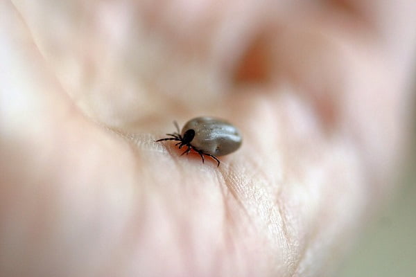 Forte augmentation des cas de maladie après une infection par le virus des tiques 6 Forte augmentation des cas de maladie après une infection par le virus des tiques - 5