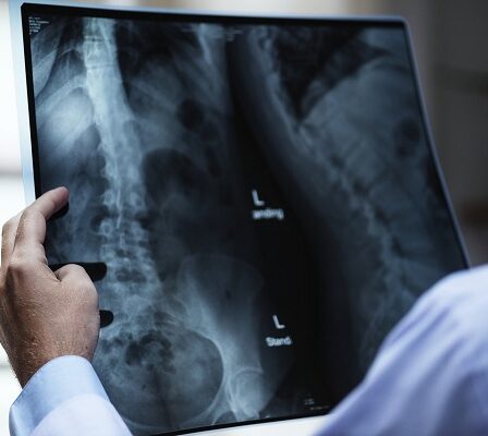 Plus de 2200 enquêtes doivent être réexaminées après que les radiologues aient négligé de graves erreurs 27 Plus de 2200 enquêtes doivent être réexaminées après que les radiologues aient négligé de graves erreurs - 26