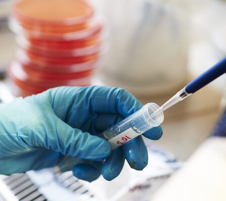 Un nouveau traitement pour le cancer héréditaire de l'ovaire approuvé en Norvège - 30