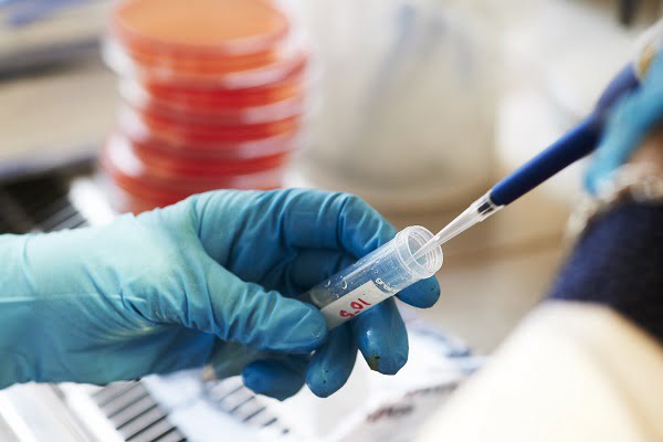 Un nouveau traitement pour le cancer héréditaire de l'ovaire approuvé en Norvège 6 Un nouveau traitement pour le cancer héréditaire de l'ovaire approuvé en Norvège - 5
