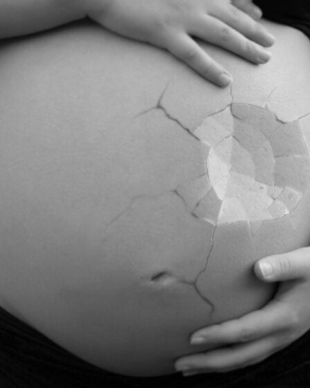 40% des femmes atteintes d'HG envisagent l'avortement - Norway Today - 15