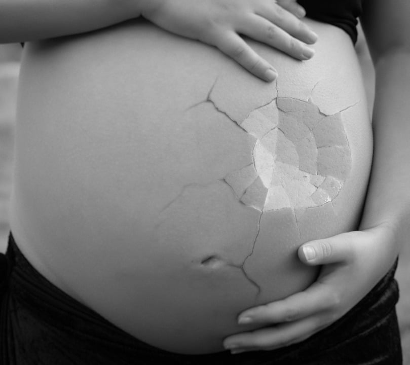 40% des femmes atteintes d'HG envisagent l'avortement - Norway Today - 5