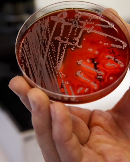 Les Norvégiens risquent de ramener des bactéries résistantes aux antibiotiques chez eux depuis l'étranger - 22