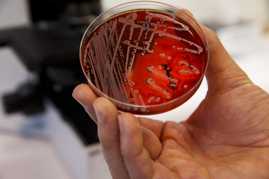 Les Norvégiens risquent de ramener des bactéries résistantes aux antibiotiques chez eux depuis l'étranger 4 Les Norvégiens risquent de ramener des bactéries résistantes aux antibiotiques chez eux depuis l'étranger - 3