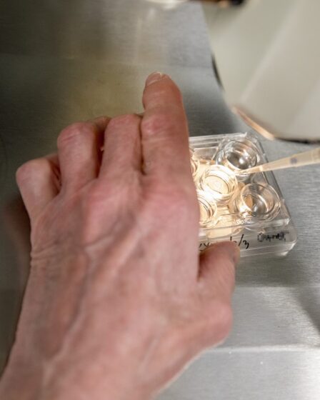 Hormone de stimulation musculaire brevetée de l'Université de Bergen 18 Hormone de stimulation musculaire brevetée de l'Université de Bergen - 17