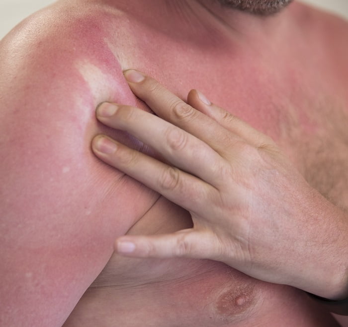 Nous avons établi un record UV en mai - avis de rayonnement encore très élevé 4 Nous avons établi un record UV en mai - avis de rayonnement encore très élevé - 3