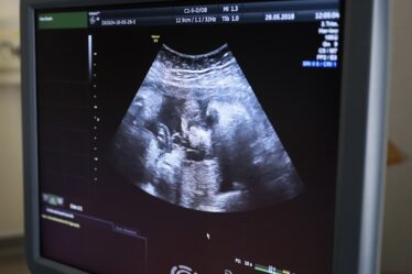 25 avortements de fœtus jumeaux en bonne santé depuis 2016 - 16