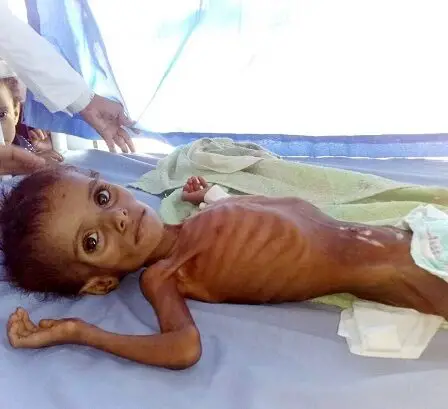 Toutes les cinq secondes, un enfant meurt quelque part dans le monde 30 Toutes les cinq secondes, un enfant meurt quelque part dans le monde - 29