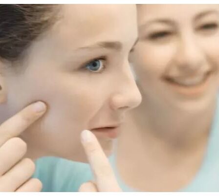 Acné pendant l'adolescence - peau jeune plus tard dans la vie 20 Acné pendant l'adolescence - peau jeune plus tard dans la vie - 19