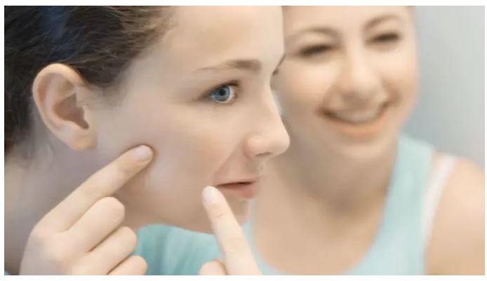 Acné pendant l'adolescence - peau jeune plus tard dans la vie - 3