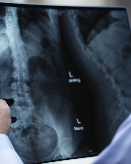 150000 personnes en Norvège souffrent de Kols (MPOC) 26 150000 personnes en Norvège souffrent de Kols (MPOC) - 25