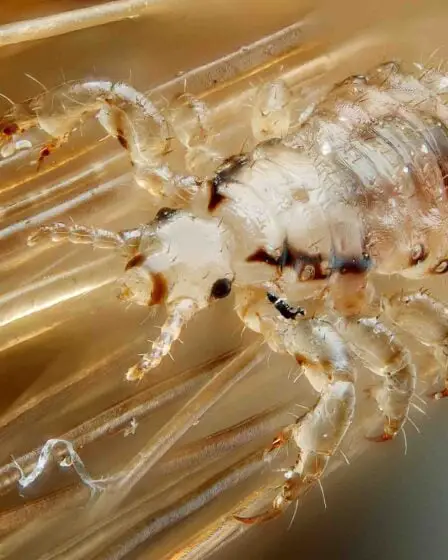 L'Institut de santé publique encourage les parents à faire un contrôle des poux une fois par mois 5 L'Institut de santé publique encourage les parents à faire un contrôle des poux une fois par mois - 4