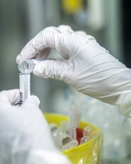 Le nouveau médicament corona a montré des résultats prometteurs lors des tests, selon une nouvelle étude 14 Le nouveau médicament corona a montré des résultats prometteurs lors des tests, selon une nouvelle étude - 13