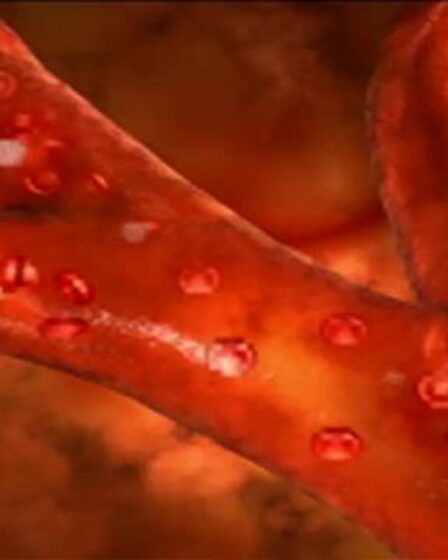 Le bon cholestérol peut encore être dangereux 5 Le bon cholestérol peut encore être dangereux - 4