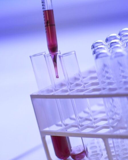 Un nouvel algorithme pourra prédire les épidémies hospitalières - 25