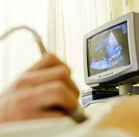 La Norvège compte le moins d'avortements chez les adolescentes dans les pays nordiques 8 La Norvège compte le moins d'avortements chez les adolescentes dans les pays nordiques - 7