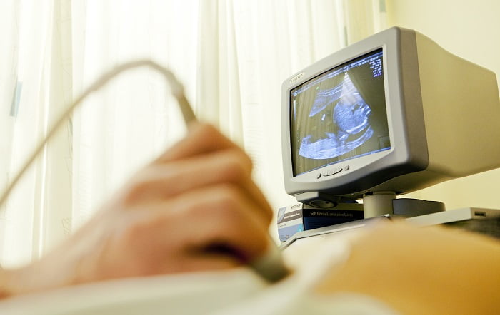 La Norvège compte le moins d'avortements chez les adolescentes dans les pays nordiques 4 La Norvège compte le moins d'avortements chez les adolescentes dans les pays nordiques - 3