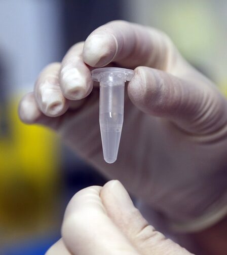 Plusieurs patients atteints de cancer du poumon reçoivent un traitement curatif réussi 11 Plusieurs patients atteints de cancer du poumon reçoivent un traitement curatif réussi - 10