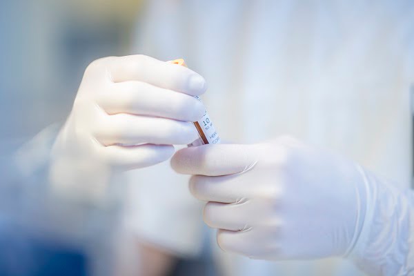32 nouveaux cas d'infection au coronavirus au cours des dernières 24 heures - 3
