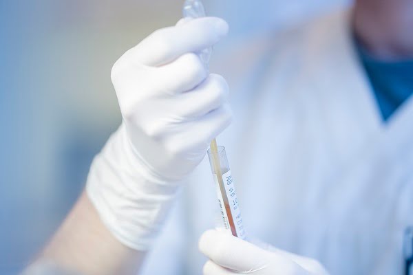 9 172 cas de coronavirus enregistrés en Norvège - 22 de plus au cours des dernières 24 heures 4 9 172 cas de coronavirus enregistrés en Norvège - 22 de plus au cours des dernières 24 heures - 3