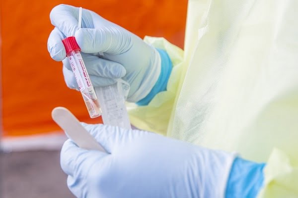 3 703 personnes en Norvège avec une infection confirmée à coronavirus 4 3 703 personnes en Norvège avec une infection confirmée à coronavirus - 3