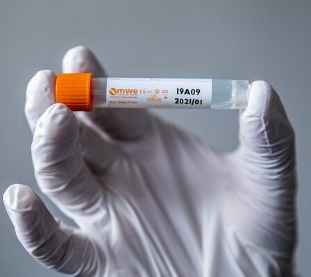 Une infection corona détectée chez des écoliers de Drammen 2 Une infection corona détectée chez des écoliers de Drammen - 1