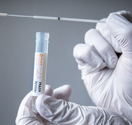 Le rapport donne le feu vert pour quelques tests rapides 8 Le rapport donne le feu vert pour quelques tests rapides - 7