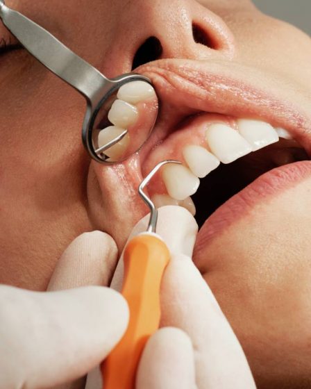 La crise corona a entraîné de longs délais d'attente pour les services publics de santé dentaire en Norvège 23 La crise corona a entraîné de longs délais d'attente pour les services publics de santé dentaire en Norvège - 22