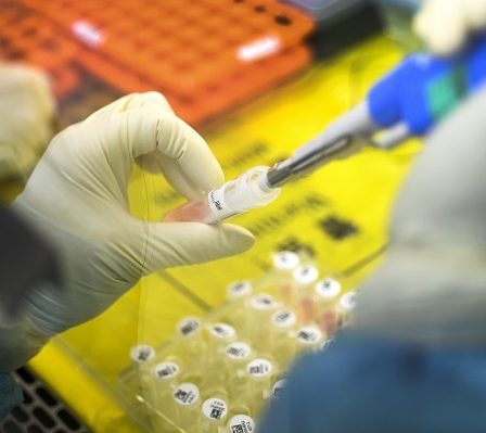31 personnes ont été testées pour le virus de Wuhan en Norvège - 19
