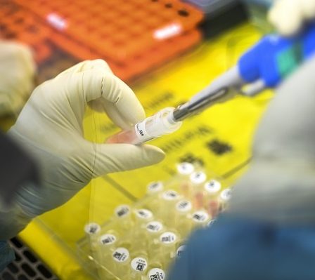 31 personnes ont été testées pour le virus de Wuhan en Norvège 2 31 personnes ont été testées pour le virus de Wuhan en Norvège - 1