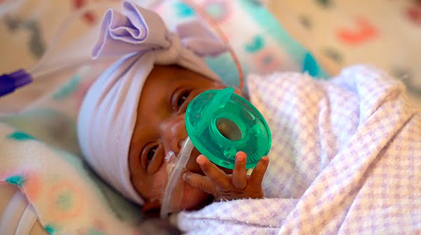 Le bébé du record du monde « Saybie » est sorti de l'hôpital 4 Le bébé du record du monde « Saybie » est sorti de l'hôpital - 3