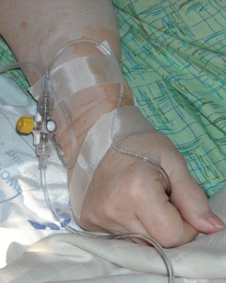 De plus en plus de personnes déposent des plaintes auprès du système norvégien d'indemnisation des patients blessés 23 De plus en plus de personnes déposent des plaintes auprès du système norvégien d'indemnisation des patients blessés - 22