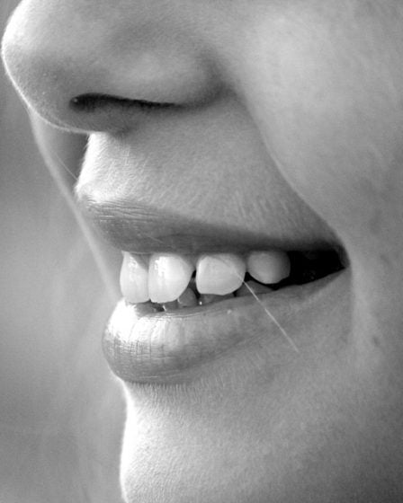 Un Norvégien de 18 ans sur quatre n'a jamais eu de caries 5 Un Norvégien de 18 ans sur quatre n'a jamais eu de caries - 4