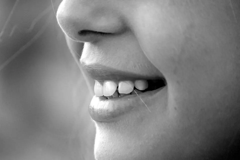 Un Norvégien de 18 ans sur quatre n'a jamais eu de caries - 3