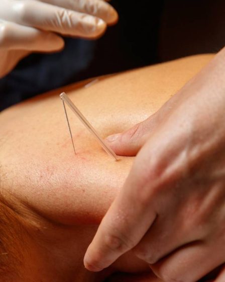 Quatre personnes à Rogaland hospitalisées après avoir subi une perforation des poumons lors d'une acupuncture 14 Quatre personnes à Rogaland hospitalisées après avoir subi une perforation des poumons lors d'une acupuncture - 13