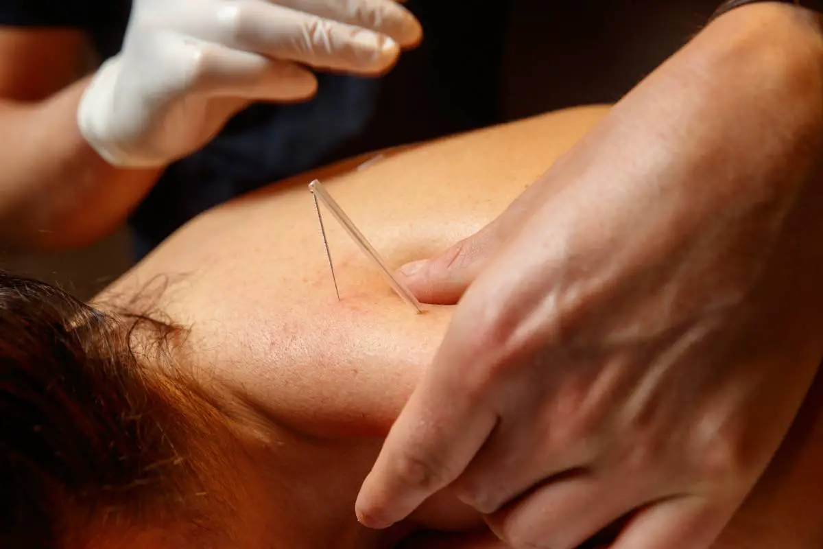 Quatre personnes à Rogaland hospitalisées après avoir subi une perforation des poumons lors d'une acupuncture 4 Quatre personnes à Rogaland hospitalisées après avoir subi une perforation des poumons lors d'une acupuncture - 3