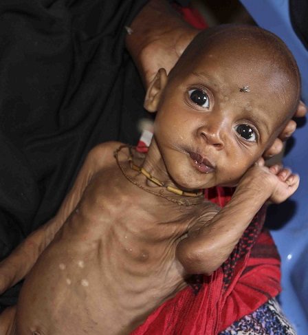 Les Nations Unies (ONU) disent que 20 millions de personnes souffrent d'une crise de la faim 2 Les Nations Unies (ONU) disent que 20 millions de personnes souffrent d'une crise de la faim - 1