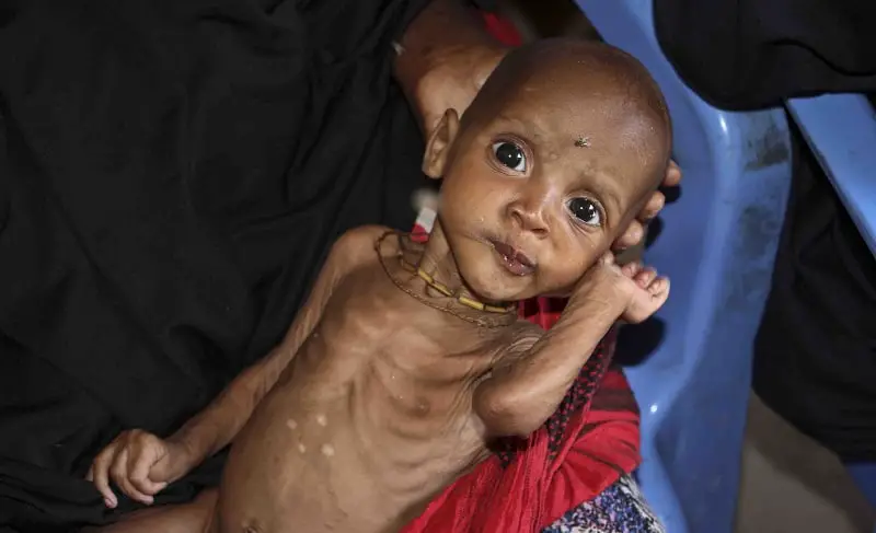 Les Nations Unies (ONU) disent que 20 millions de personnes souffrent d'une crise de la faim - 3