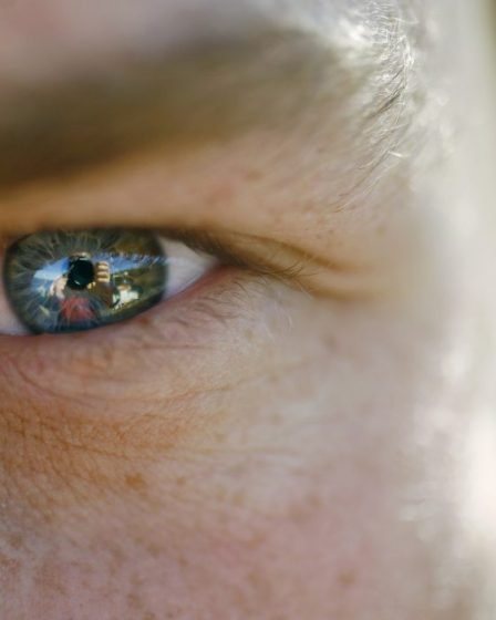 Plus de cinq millions de couronnes de dommages et intérêts pour faute professionnelle au laser 5 Plus de cinq millions de couronnes de dommages et intérêts pour faute professionnelle au laser - 4