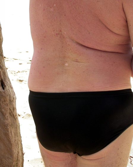 Un chercheur trompé avec la recherche sur l'obésité - 13