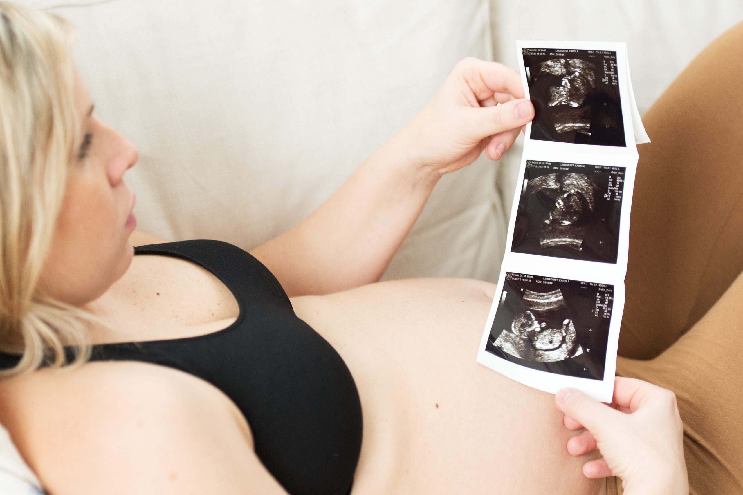 Les sages-femmes tirent la sonnette d'alarme sur les soins de maternité 4 Les sages-femmes tirent la sonnette d'alarme sur les soins de maternité - 3