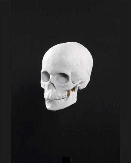 Une reconstitution étonnante révèle un "garçon solitaire" au crâne déformé, mort dans une grotte en Norvège il y a 8 300 ans. - 10