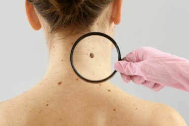 Augmentation spectaculaire du nombre de cancers de la peau en Norvège - 18